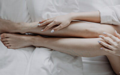 ¿Problemas circulatorios?